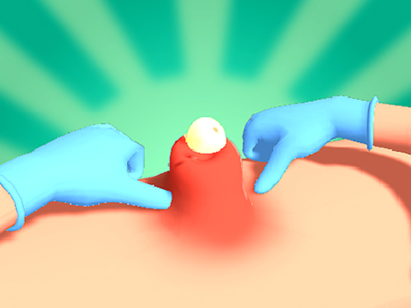 Cluiche Pimple Squeeze ar líne